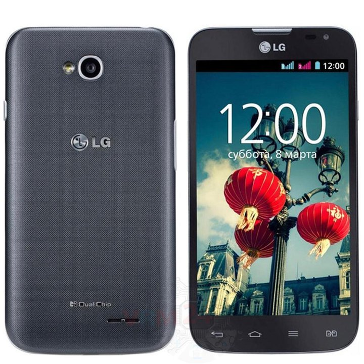 LG L70 D325
